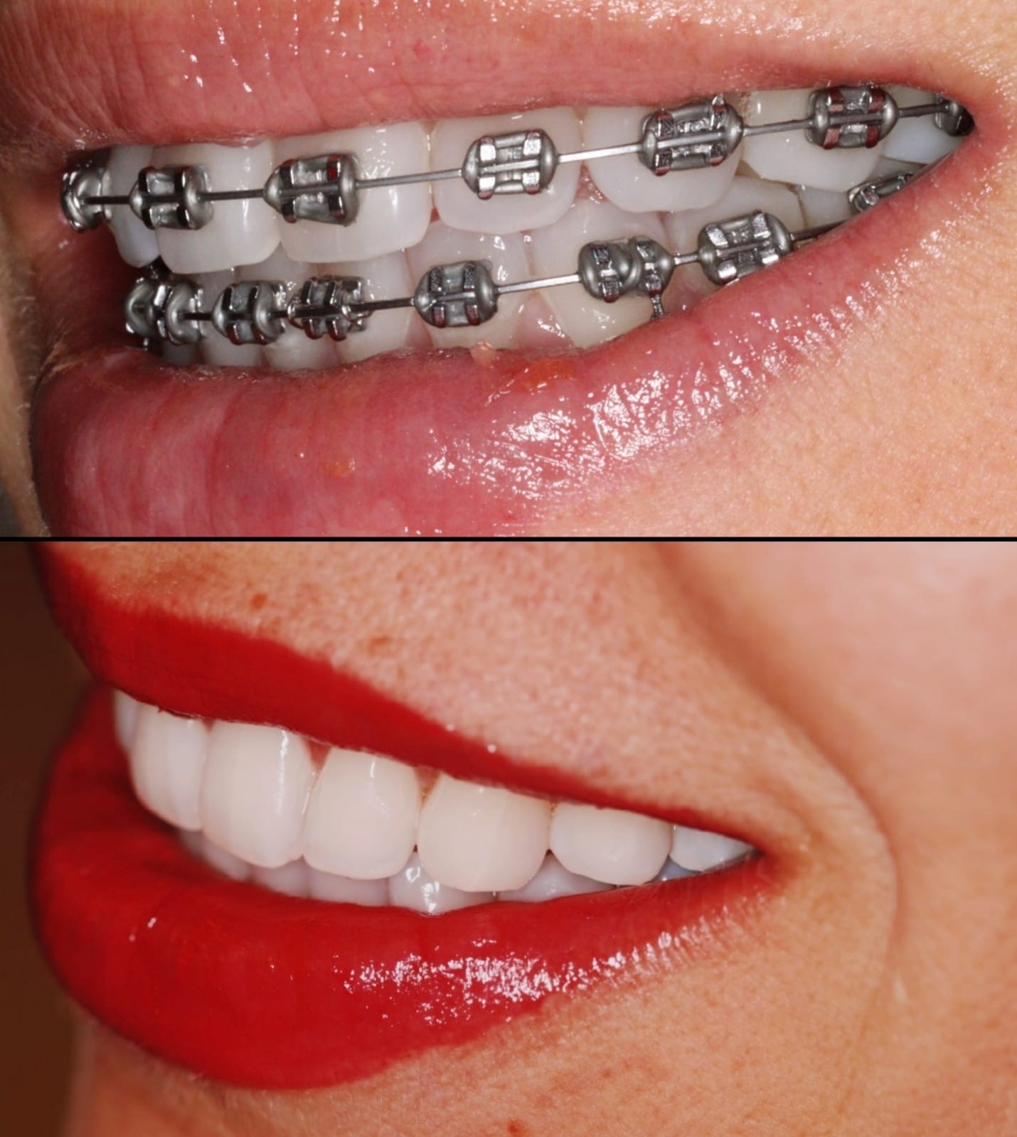 ortodoncia_dental-experience_bogota