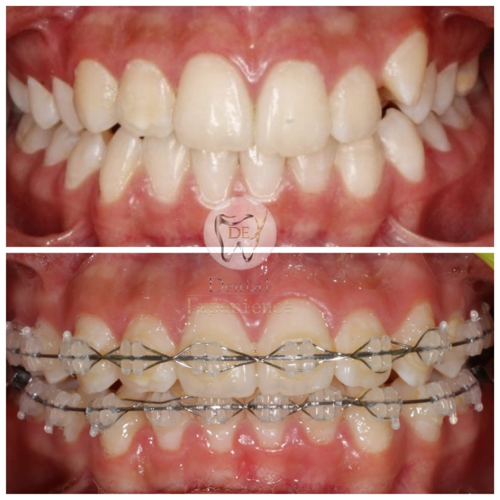 ortodoncia_dental-experience_bogota